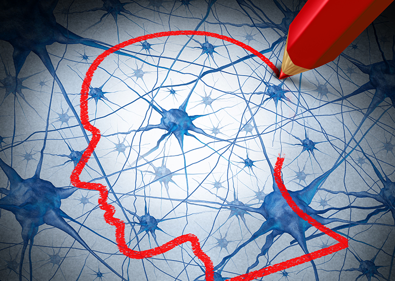 brain connections Alzheimer's illustration